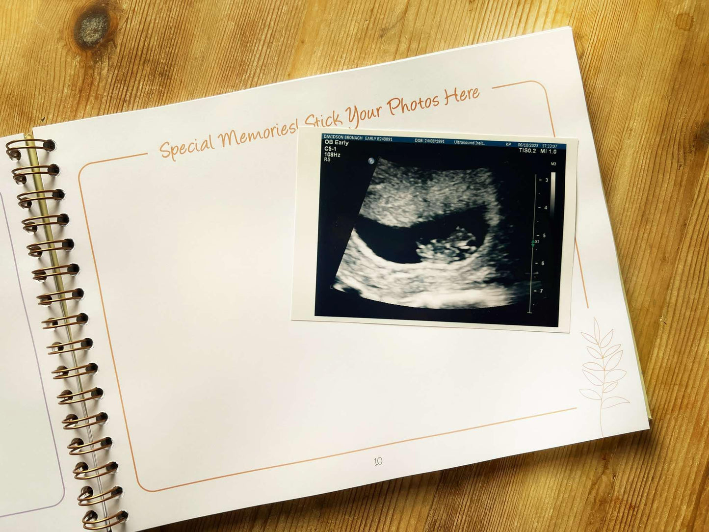 my pregnancy journal and baby ultrasound