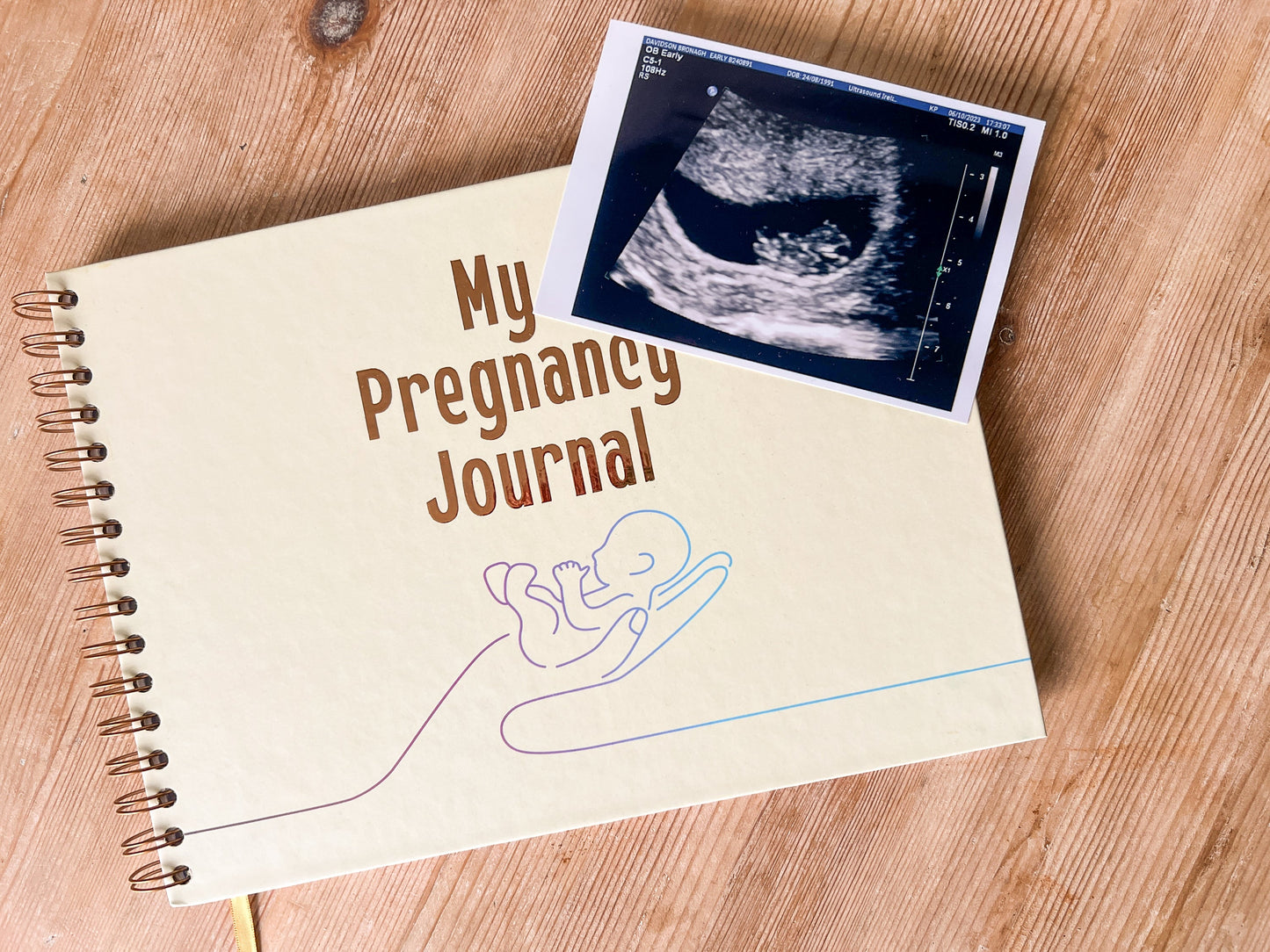 my pregnancy journal with ultrasound